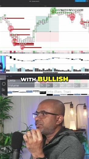 Simple SETUP to Make Your First $10,000 using PROP FIRMs | Order Flow & Volume Profile | #trading