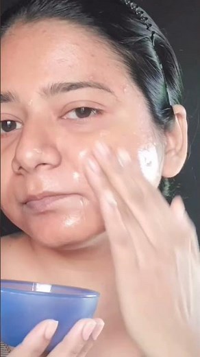 Get Rid of Pimples OVERNIGHT with Aloe Vera! 🌿 #skincare #pimple