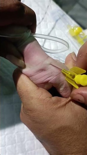 #Nursing knowledge #Nurse# Medicos # Apron beauty............#medical student #