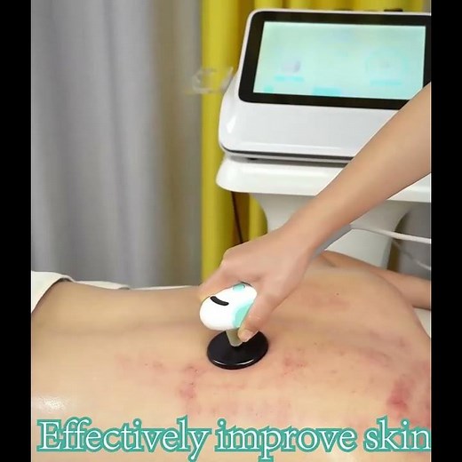 448k Cet Ret RF Muscle Stimulator Machine – Belly Slimming, Body Sculpting & Fascia Care