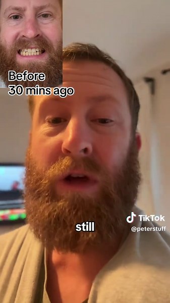 That’s impressive for only 30 minutes of teeth whitening