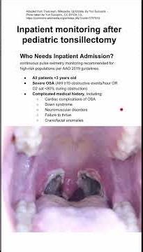 Inpatient monitoring after pediatric tonsillectomy