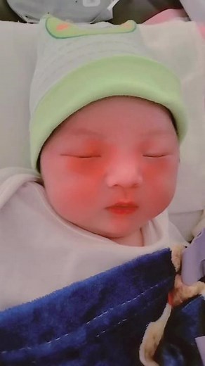 xót cho con quá .da còn non mà mẹ lấy thuốc nhổ mắt làm bỏng da con rồi.😞😞 con xanh đc 3 ngày r.