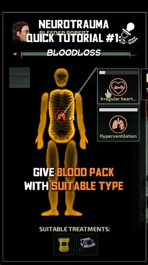 Neurotrauma Tutorial: Bloodloss #barotrauma