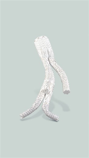 ゴア® エクスクルーダー® IBE | 日本ゴア メディカル製品