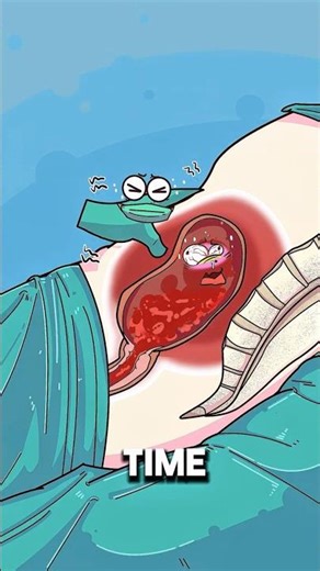 Why Doctors Press the belly after birth?! #animation #health