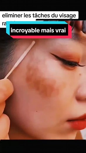 Éliminer les Taches du Visage Rapidement : Remède Naturel