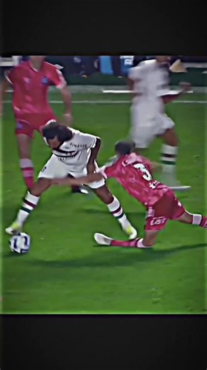 Broken in One Moment 💔 Marcelo’s Unlucky Tackle