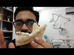 How to anaesthesize a hot tooth?