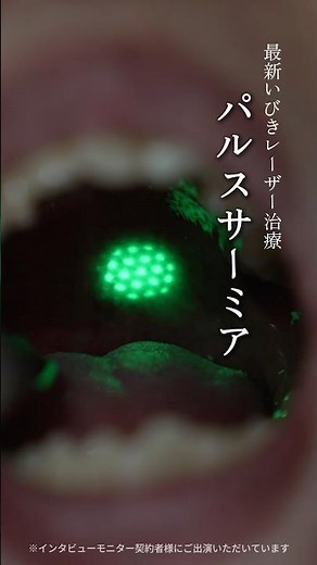 最新いびきレーザー治療【パルスサーミア】の体験レビュー #いびき #いびき治療 #パルスサーミア #shorts