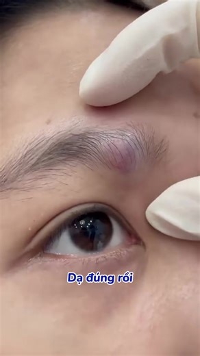 It looked small, but wait till you see the ending! #drpimplepopper #grossaddiction | Pimple 2022