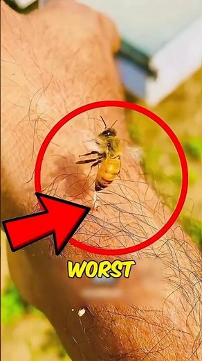 If you ever get stung by a bee, never do this first