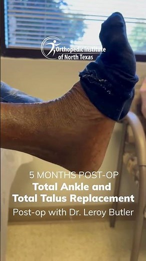 Total Ankle Replacement Recovery – 5 Months Post Surgery | Dr. Butler