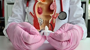 Cum se folosesc corect supozitoarele pentru hemoroizi? Sfaturi și recomandări