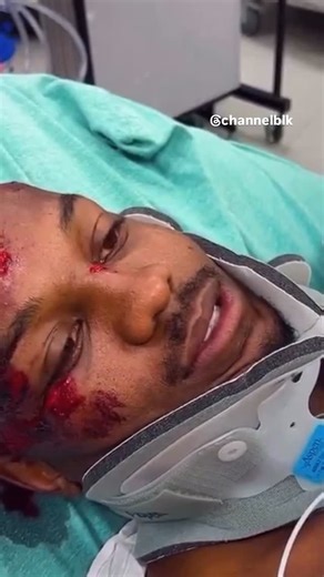 Channel Blk on Instagram: "Lil Woody is Responsive and Recovering in the Hospital after an almost Fatal Dirt Bike Crash Earlier Tonight. 🙏🏾"