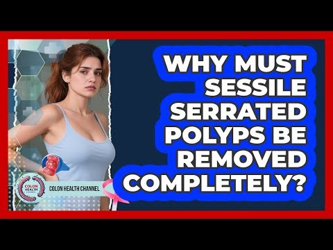 Why Must Sessile Serrated Polyps Be Removed Completely?