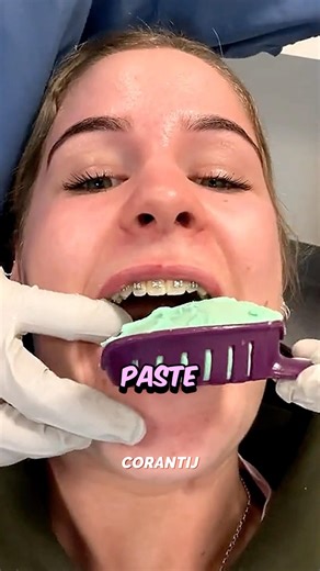 Dentist mold