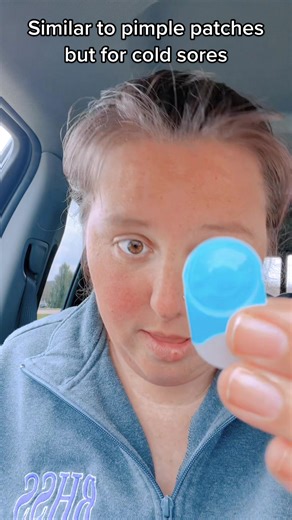 Cold Sore Relief Patch - A Game Changer for Cold Sore Sufferers