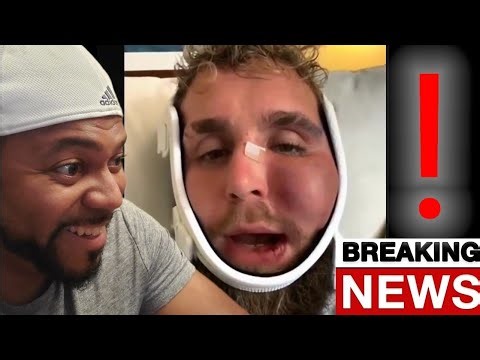 BREAKING NEWS ‼️ JAKE PAUL REVEALS X-RAY OF THE BROKEN AREAS OF HIS JAW WIRED SHUT ‼️