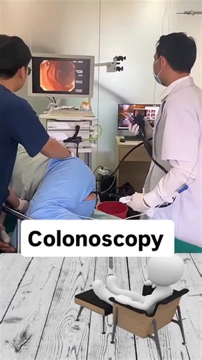 Dr Himesh Upadhyay on Instagram: "A colonoscopy is a medical procedure using a flexible tube with a camera (colonoscope) inserted through the rectum to examine the entire large intestine (colon) and rectum for abnormalities like inflammation, ulcers, polyps, or cancer, allowing for tissue sampling (biopsy) or polyp removal during the exam, often done under sedation to prevent discomfort, and is crucial for colorectal cancer screening. Proper bowel prep (diet changes, laxatives) is essential for 