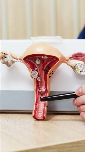 Reproductive Cancers Explained | Early Warning Signs Every Woman Must Know