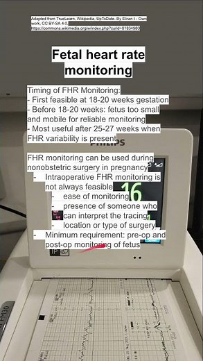 Fetal heart rate monitoring