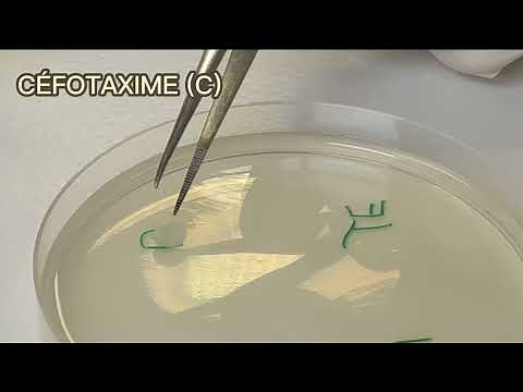 Spécialité SVT - Compte rendu sous forme d'une vidéo, du TP antibiogramme