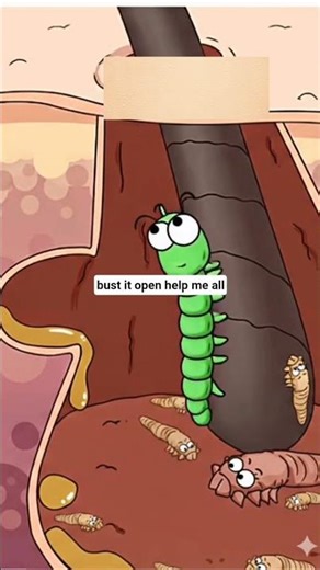 Why Makeup Triggers Pimples?#shorts #amimation #healthhumor