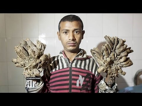 Man Turning into a Tree?