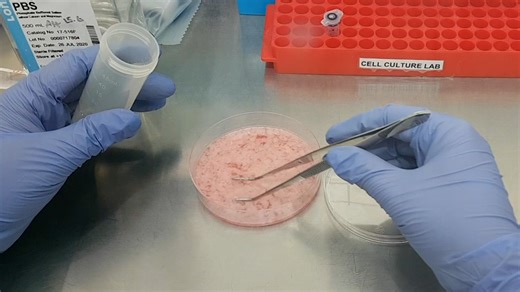 Isolation of Rat Adipose Tissue Mesenchymal Stem Cells for Differentiation into Insulin-producing Cells