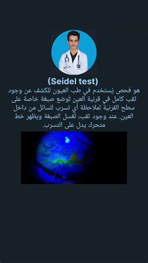 اختبار سيدل(Seidel test) #دكتور_سيرجن #طب
