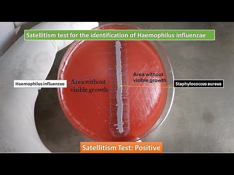Satellitism Test for Identification of Haemophilus influenzae |Satellitism Test Positive