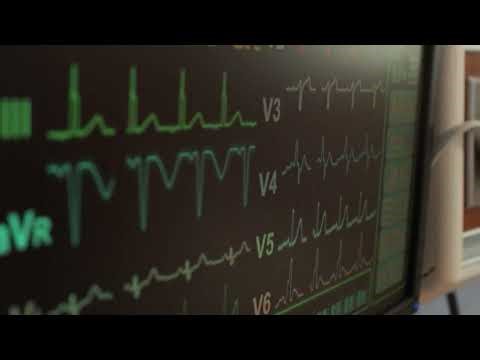 ECG Test at Our Hospital