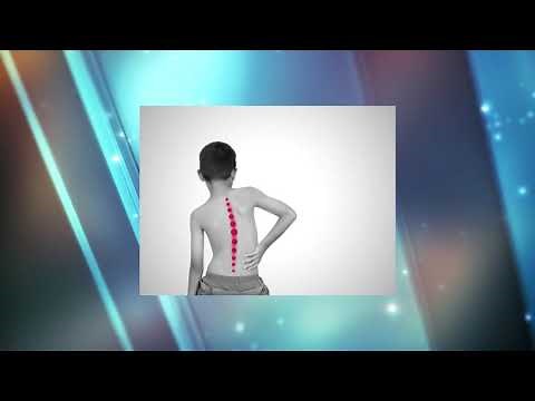 What is RICKETS in CHILDREN? Causes, symptoms, treatment | Vitamin D and children