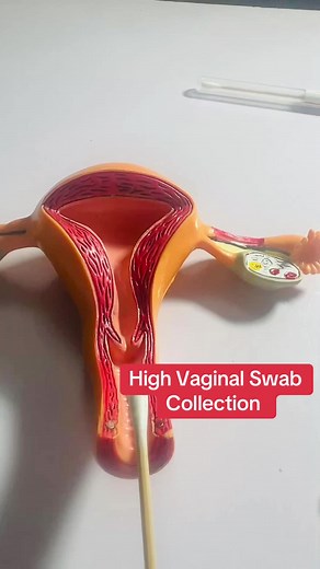High Vaginal Swab Collection Procedure for Women's Health