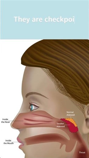 What are adenoids and tonsils?
