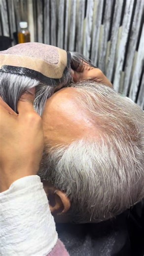 Best Hair Replacement at Capital Hair Club Faisalabad