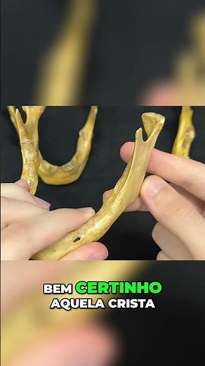 Anatomy of the Mandible: Details and Essential Structures
