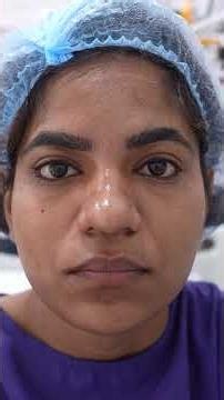 Full Facemakeover Surgery for a Girl