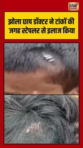 Doctor ने टांकों की जगह Stapler Pin से इलाज किया #shorts #viralnews #viralvideo #bihar #nawada