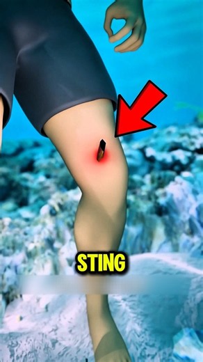 🦂 What REALLY Happens When You Step on a Stingray 😱