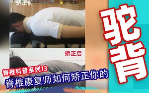 脊椎科普系列13-脊椎康复师如何矫正你的驼背
