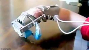 Tangan Balita Ini Terbuat dari Printer 3D