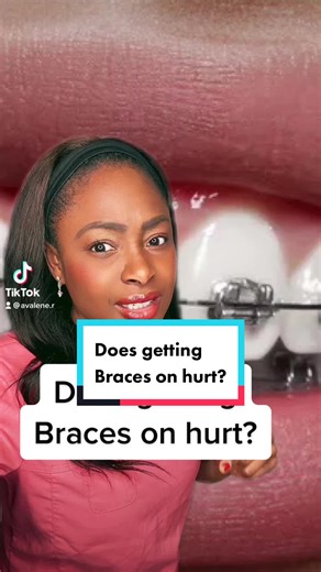 Do Braces Hurt When They're Applied?