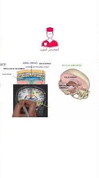 falx cerebri tentoriam cerebelli