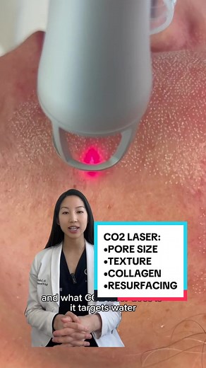 Co2 laser is great because it resurfaces your skin and helps with skin texture, pore size, and builds collagen! Love Co2 laser. #co2laser #skincare #collagen #poresize #howtominimisepores