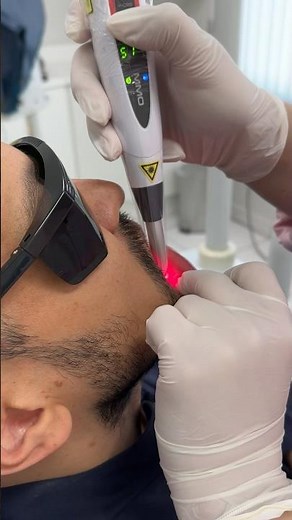 A laserterapia é uma das melhores formas de tratar aftas, ou úlceras aftosas recorrentes #laser