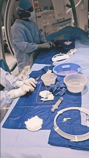 Stratus V.I.S ergonomic system; 300cm wire microcatheter exchange