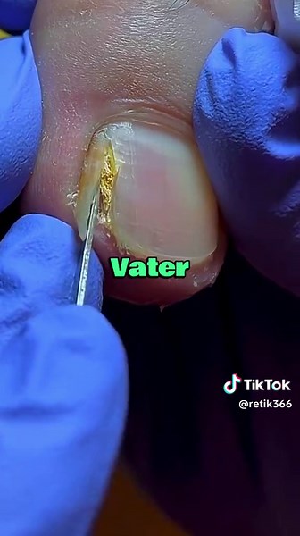 Teil 1 #redditstories #strorytime #redditgermany #redditreadings #strorytimemany