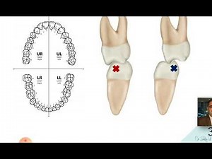 Single Denture-Advanced Complete Prosthodontics